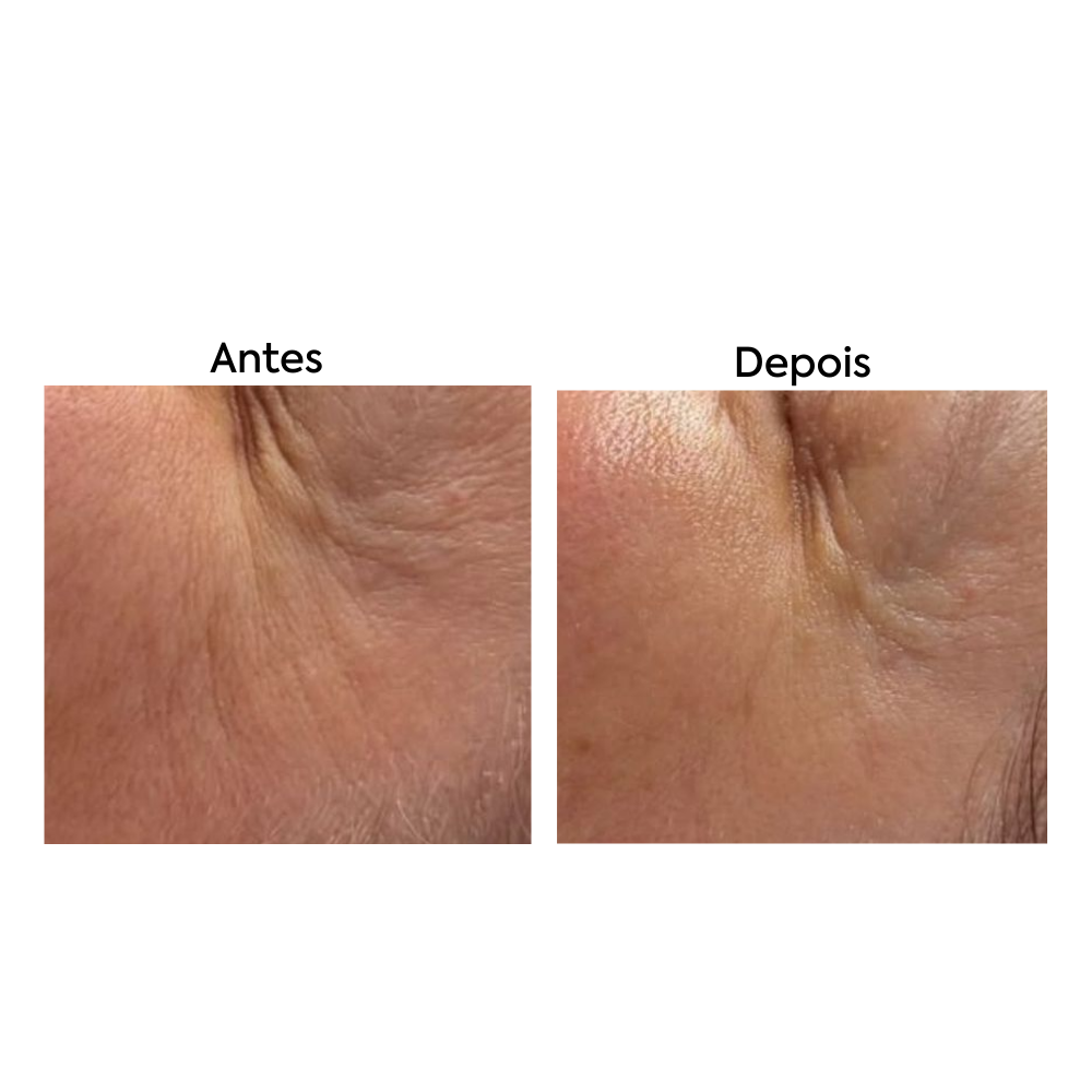 Sérum Anti-idade com Colágeno Hidrolisado