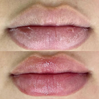 Gloss Labial Hidratante com Ácido Hialurônico