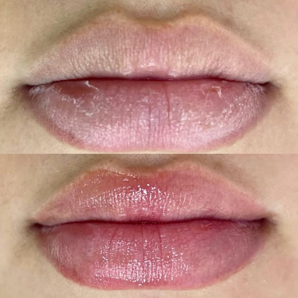 Gloss Labial Hidratante com Ácido Hialurônico