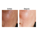 Sérum Antioxidante com Vitamina C