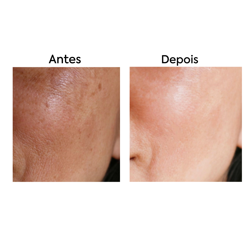 Sérum Antioxidante com Vitamina C